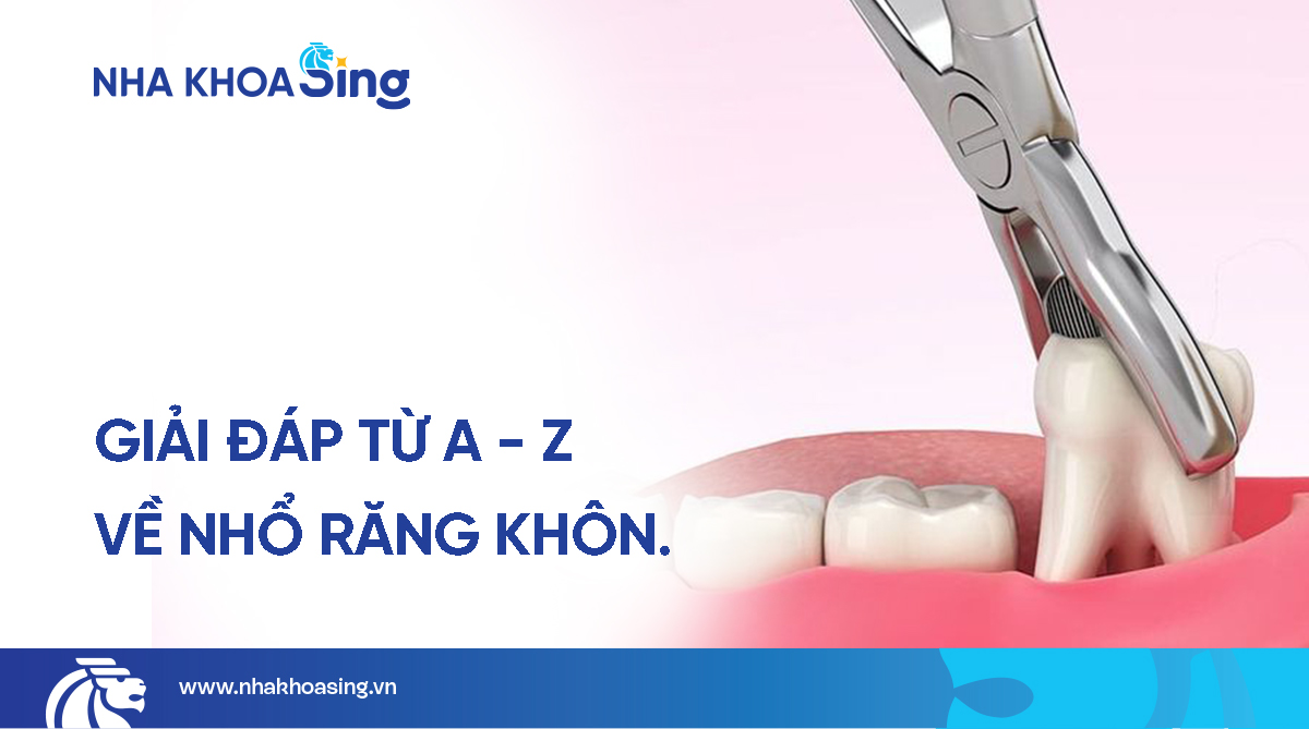 Nhổ răng khôn: Phương pháp nhổ, chi phí & lưu ý chăm sóc