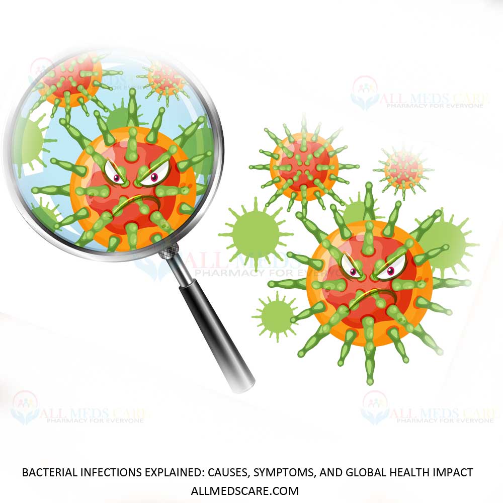 Bacterial Infections Explained: Causes, Symptoms, and Global Health Impact
