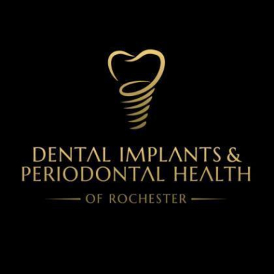 Dental Implants and Periodontal Healt